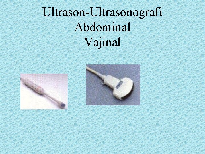 Ultrason-Ultrasonografi Abdominal Vajinal 