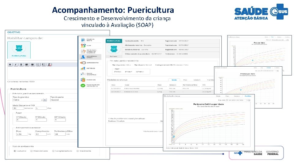 Acompanhamento: Puericultura Crescimento e Desenvolvimento da criança vinculado à Avaliação (SOAP) 