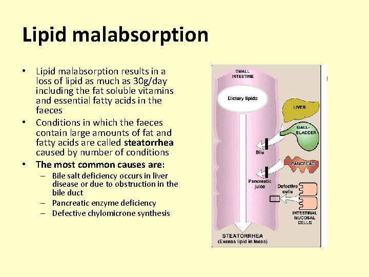Lipid malabsorption • Lipid malabsorption results in a loss of lipid as much as