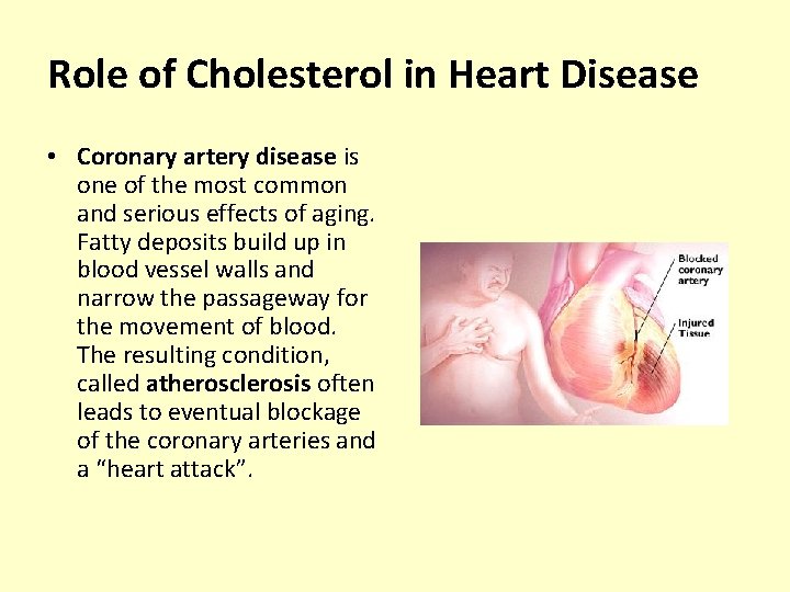 Role of Cholesterol in Heart Disease • Coronary artery disease is one of the