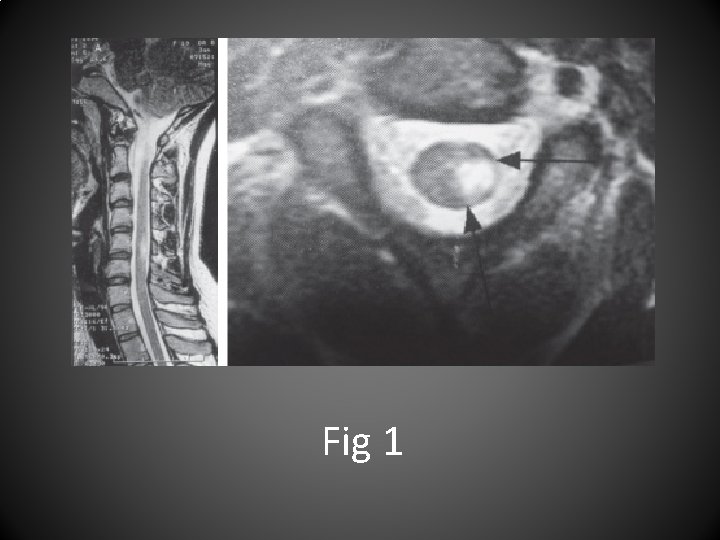 Fig 1 