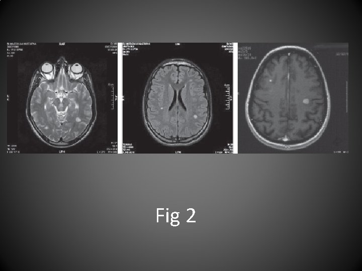 Fig 2 