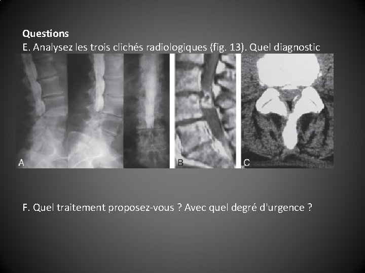 Questions E. Analysez les trois clichés radiologiques (fig. 13). Quel diagnostic retenez-vous ? F.