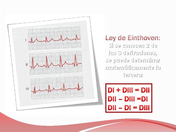 Ley de Einthoven: Si se conocen 2 de las 3 derivaciones, se puede determinar