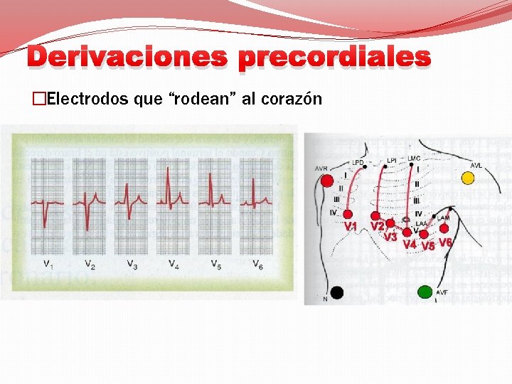 Derivaciones precordiales �Electrodos que “rodean” al corazón 