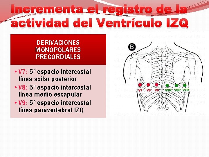 Incrementa el registro de la actividad del Ventrículo IZQ DERIVACIONES MONOPOLARES PRECORDIALES • V