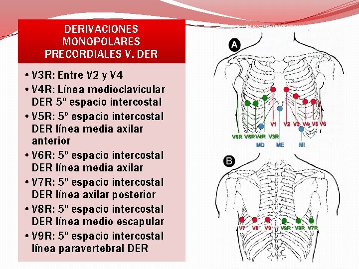 DERIVACIONES MONOPOLARES PRECORDIALES V. DER • V 3 R: Entre V 2 y V