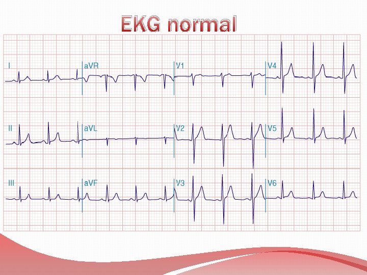 EKG normal 