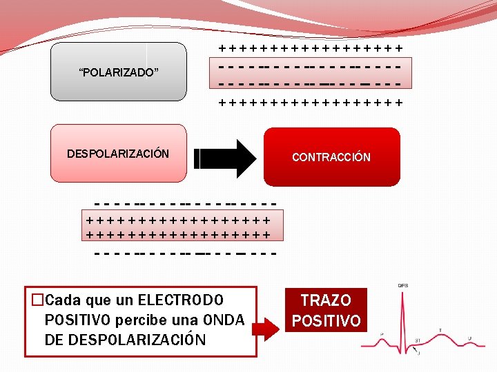 +++++++++ “POLARIZADO” - - -- - - - -- - - -- - +++++++++
