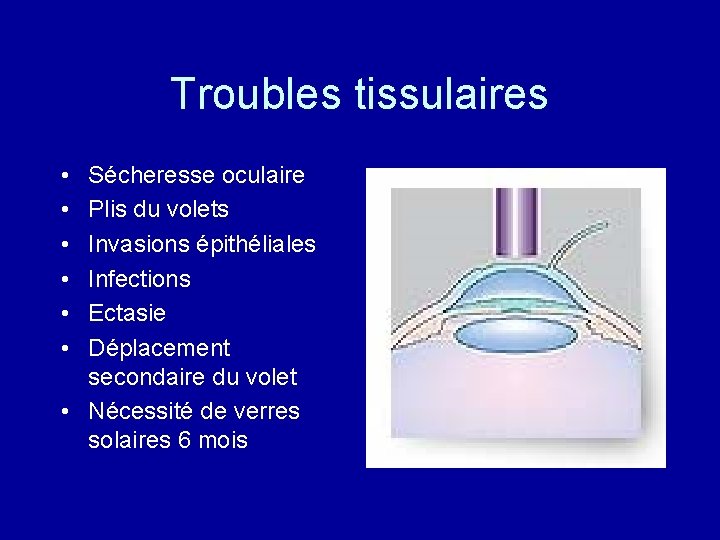 Troubles tissulaires • • • Sécheresse oculaire Plis du volets Invasions épithéliales Infections Ectasie