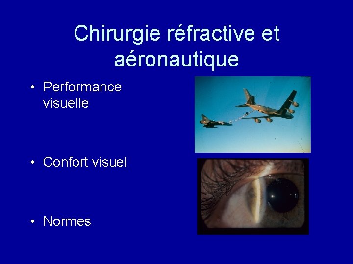 Chirurgie réfractive et aéronautique • Performance visuelle • Confort visuel • Normes 