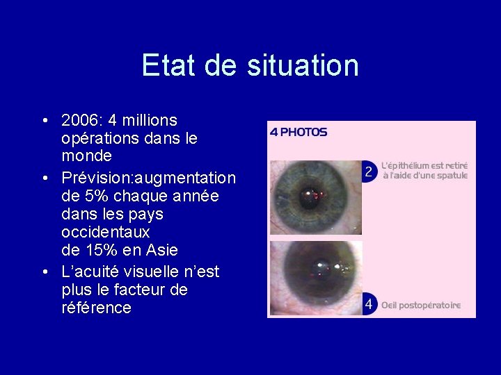 Etat de situation • 2006: 4 millions opérations dans le monde • Prévision: augmentation
