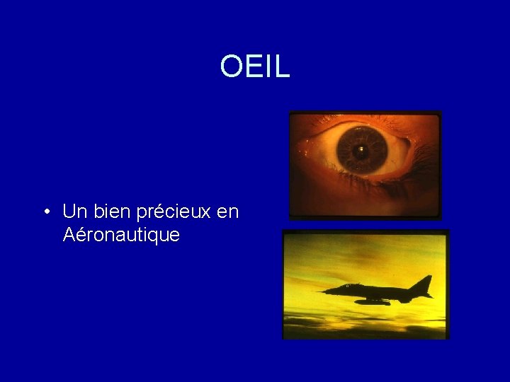 OEIL • Un bien précieux en Aéronautique 