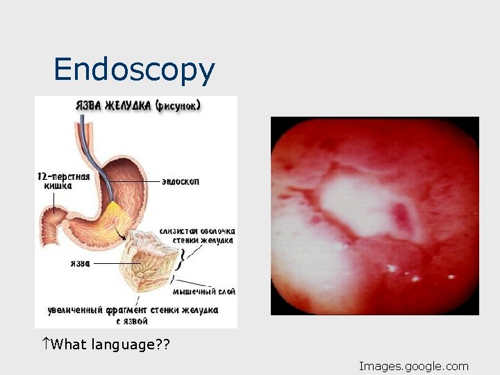 Endoscopy What language? ? Images. google. com 