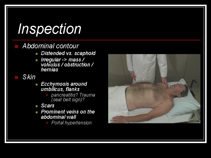 Inspection n Abdominal contour n n n Distended vs. scaphoid Irregular -> mass /