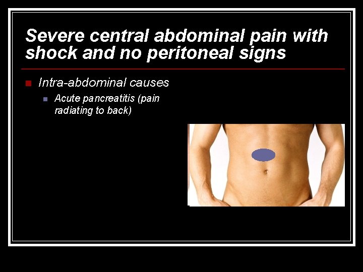 Severe central abdominal pain with shock and no peritoneal signs n Intra-abdominal causes n