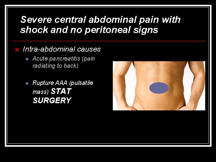 Severe central abdominal pain with shock and no peritoneal signs n Intra-abdominal causes n