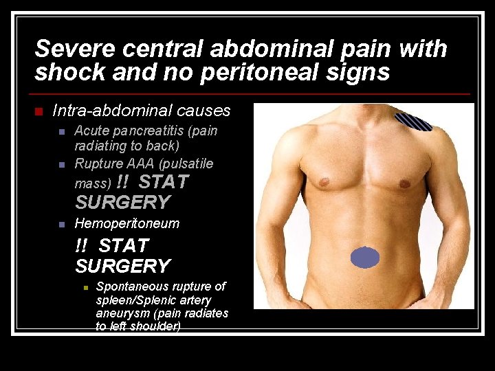 Severe central abdominal pain with shock and no peritoneal signs n Intra-abdominal causes n