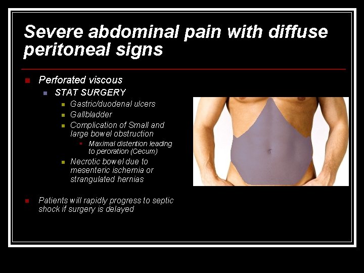 Severe abdominal pain with diffuse peritoneal signs n Perforated viscous n STAT SURGERY n