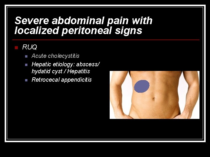 Severe abdominal pain with localized peritoneal signs n RUQ n n n Acute cholecystitis