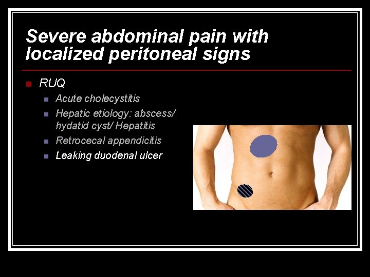 Severe abdominal pain with localized peritoneal signs n RUQ n n Acute cholecystitis Hepatic