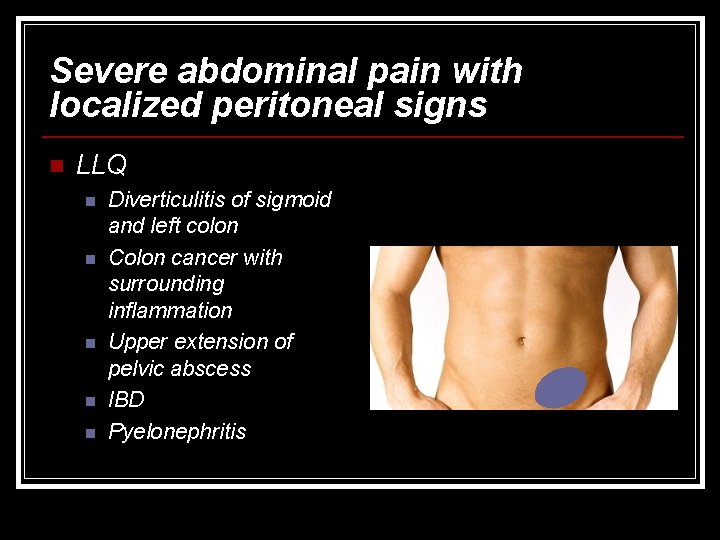 Severe abdominal pain with localized peritoneal signs n LLQ n n n Diverticulitis of