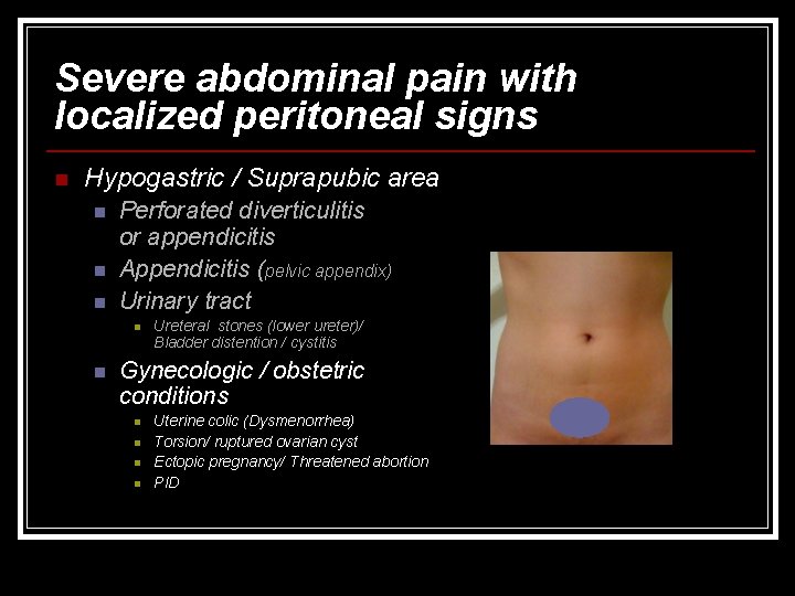 Severe abdominal pain with localized peritoneal signs n Hypogastric / Suprapubic area n n