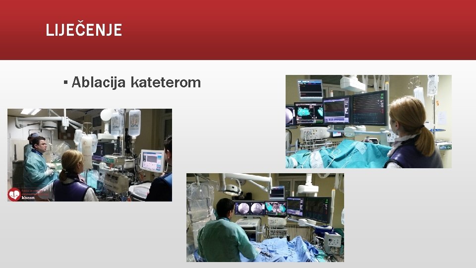 LIJEČENJE ▪ Ablacija kateterom 