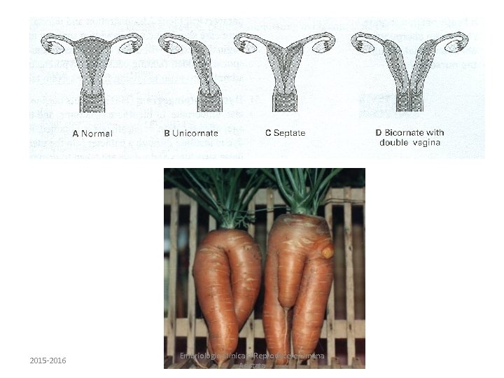 2015 -2016 Embriologie Clinica si Reproducere Umana Asistata 