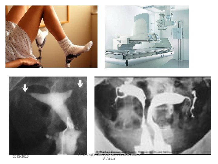 2015 -2016 Embriologie Clinica si Reproducere Umana Asistata 