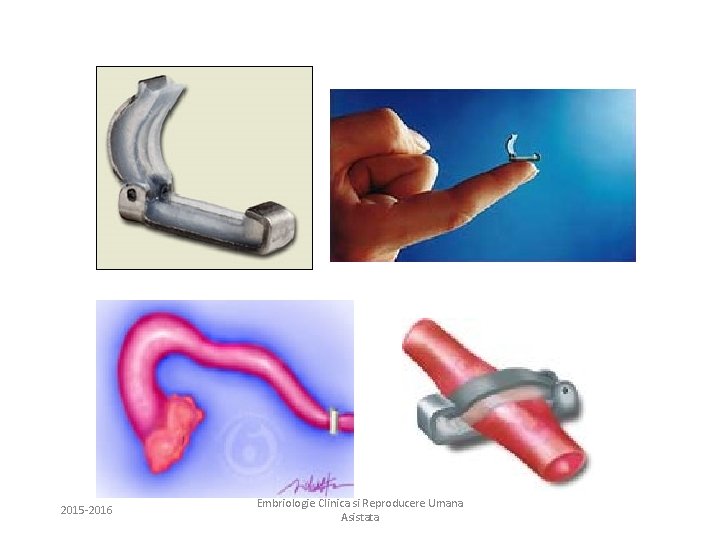 2015 -2016 Embriologie Clinica si Reproducere Umana Asistata 