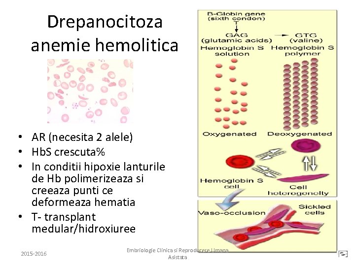 Drepanocitoza anemie hemolitica • AR (necesita 2 alele) • Hb. S crescuta% • In