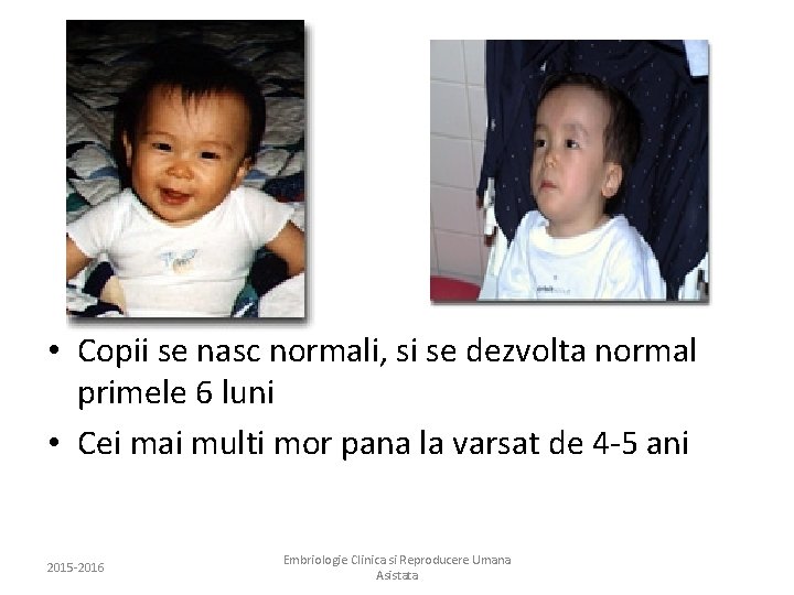  • Copii se nasc normali, si se dezvolta normal primele 6 luni •