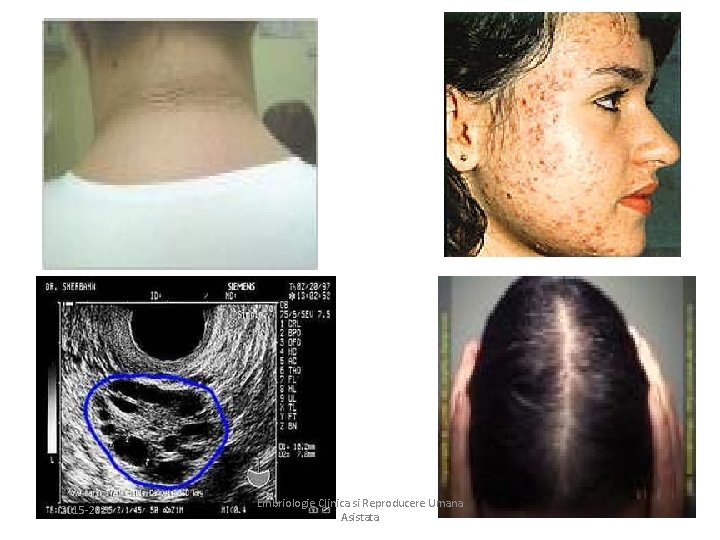 2015 -2016 Embriologie Clinica si Reproducere Umana Asistata 