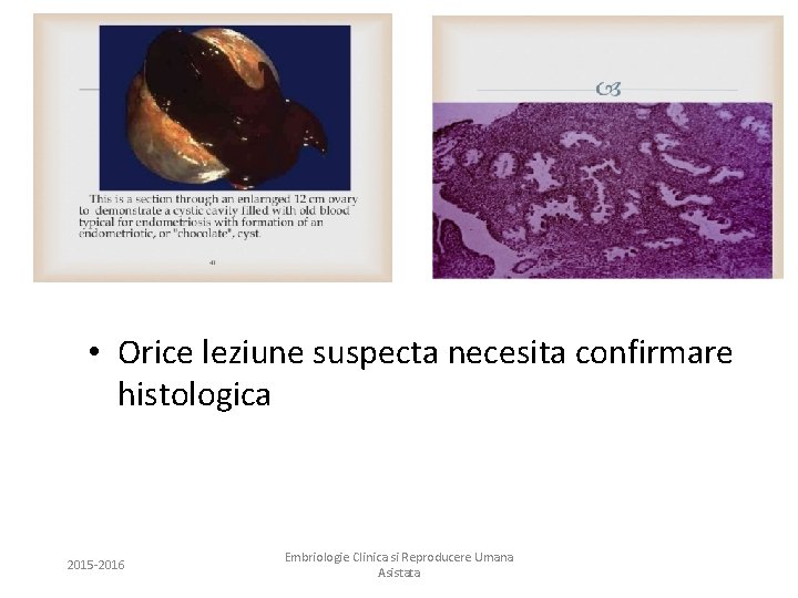  • Orice leziune suspecta necesita confirmare histologica 2015 -2016 Embriologie Clinica si Reproducere