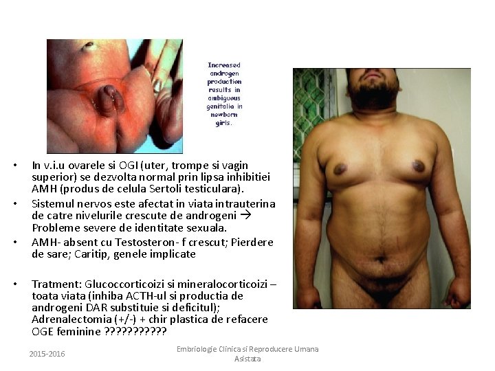  • • In v. i. u ovarele si OGI (uter, trompe si vagin