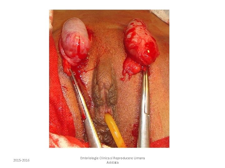 2015 -2016 Embriologie Clinica si Reproducere Umana Asistata 