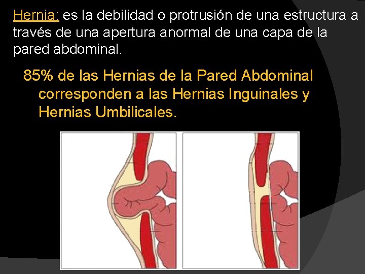 Hernia: es la debilidad o protrusión de una estructura a través de una apertura