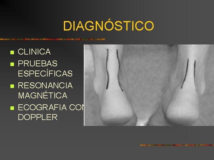 DIAGNÓSTICO n n CLINICA PRUEBAS ESPECÍFICAS RESONANCIA MAGNÉTICA ECOGRAFIA CON DOPPLER 