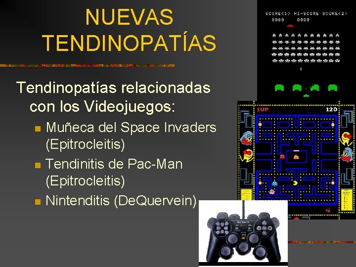 NUEVAS TENDINOPATÍAS Tendinopatías relacionadas con los Videojuegos: n n n Muñeca del Space Invaders