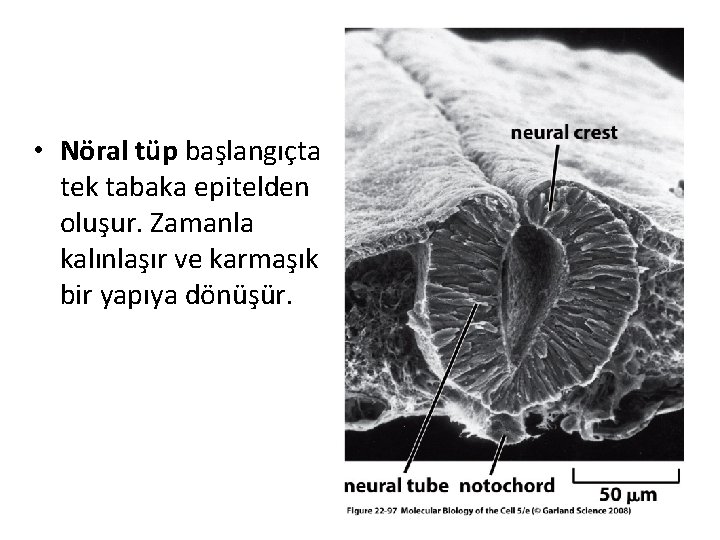  • Nöral tüp başlangıçta tek tabaka epitelden oluşur. Zamanla kalınlaşır ve karmaşık bir