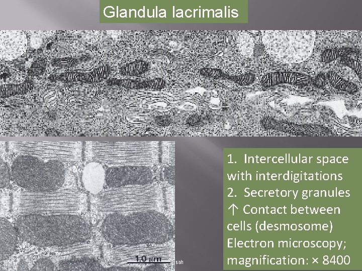 Glandula lacrimalis 12/1/2020 nur anisah 1. Intercellular space with interdigitations 2. Secretory granules ↑