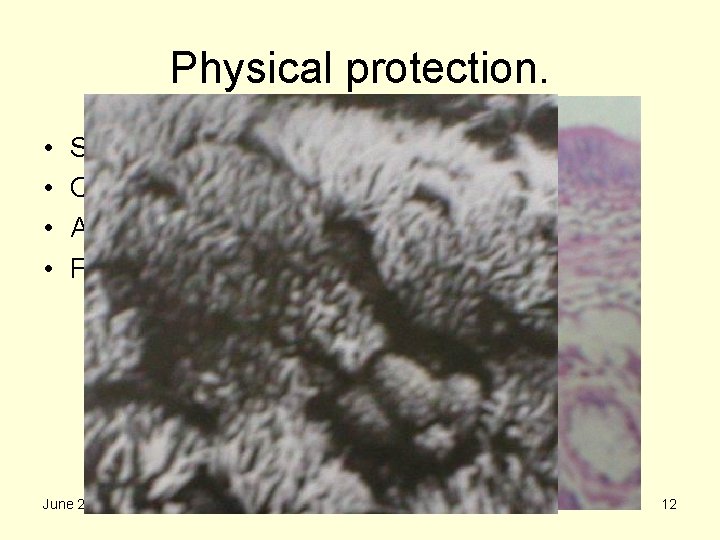 Physical protection. • • Skin. Cilia and mucus. Acid in stomach. Flow of tears.