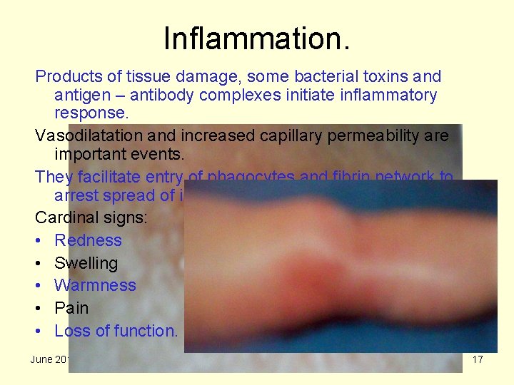 Inflammation. Products of tissue damage, some bacterial toxins and antigen – antibody complexes initiate
