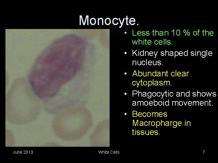 Monocyte. • Less than 10 % of the white cells. • Kidney shaped single