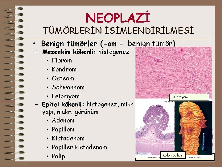 NEOPLAZİ TÜMÖRLERİN İSİMLENDİRİLMESİ • Benign tümörler (-om = benign tümör) – Mezenkim kökenli: histogenez