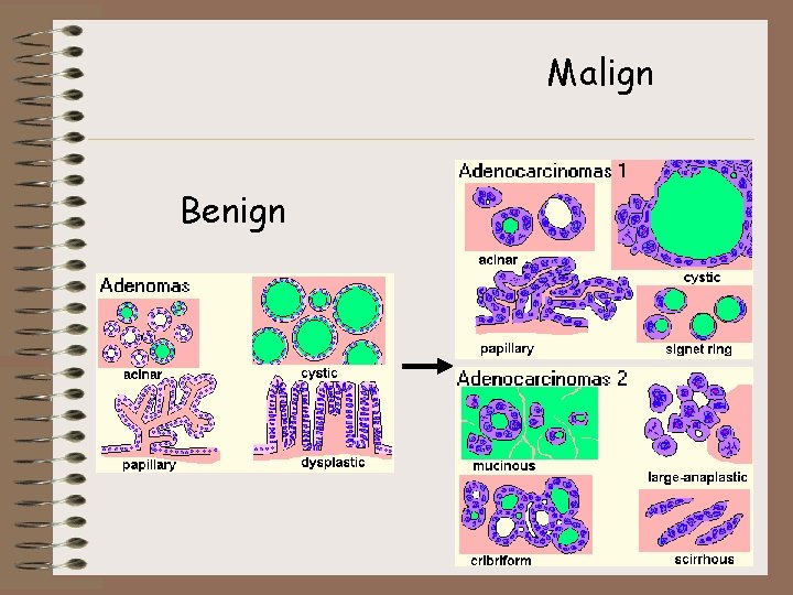 Malign Benign 