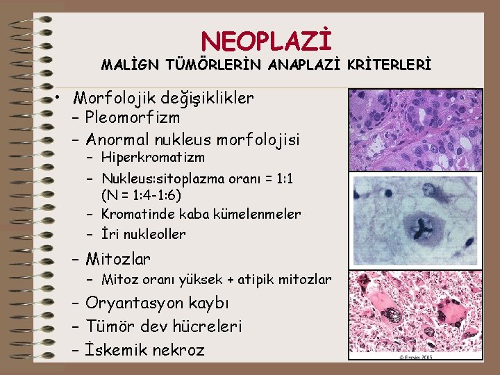 NEOPLAZİ MALİGN TÜMÖRLERİN ANAPLAZİ KRİTERLERİ • Morfolojik değişiklikler – Pleomorfizm – Anormal nukleus morfolojisi