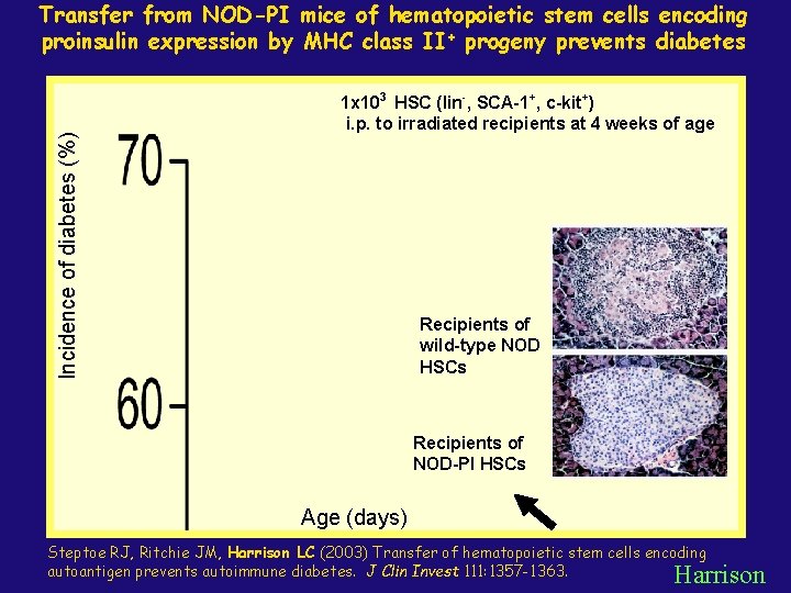 Incidence of diabetes (%) Transfer from NOD-PI mice of hematopoietic stem cells encoding proinsulin