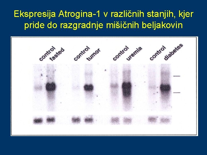 Ekspresija Atrogina-1 v različnih stanjih, kjer pride do razgradnje mišičnih beljakovin 